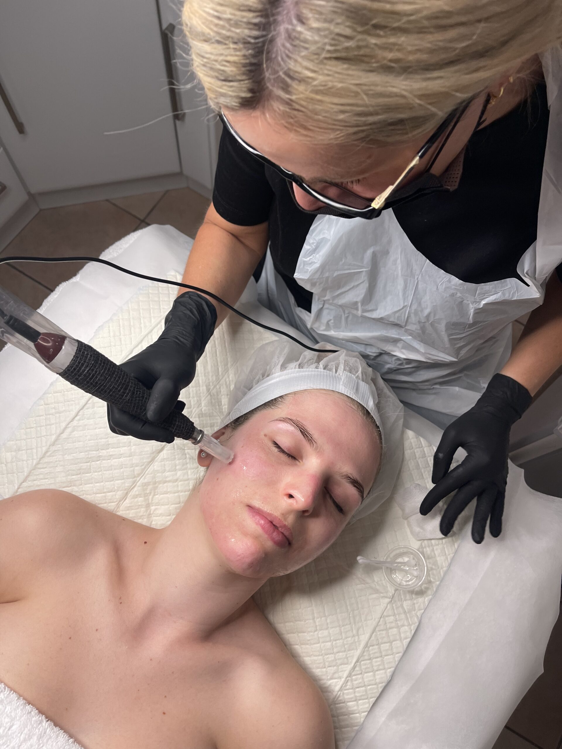 BEAUTY-INK-Microneedling- (1)