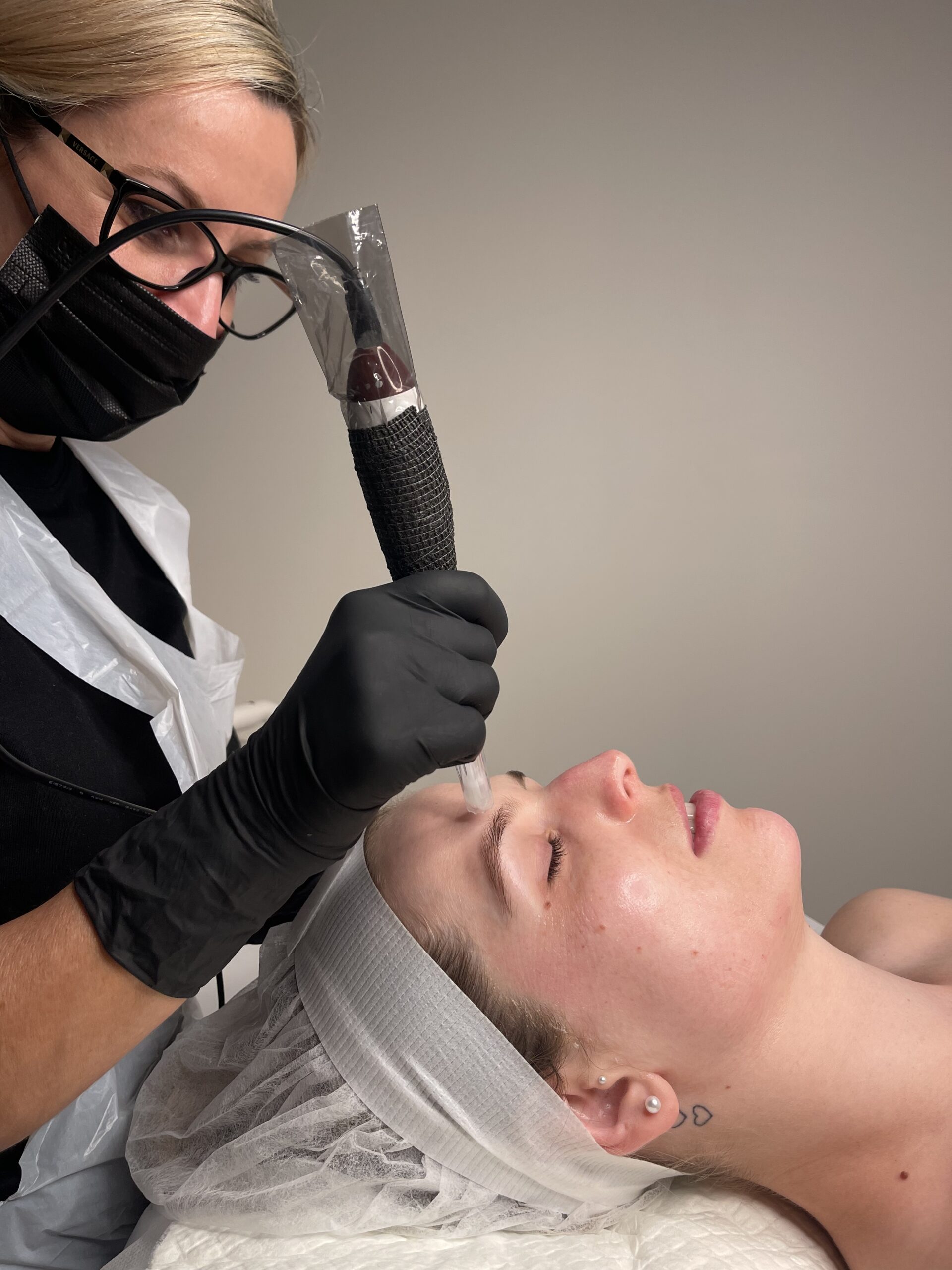 BEAUTY-INK-Microneedling- (5)